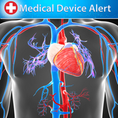 Dangers of IVC Filter